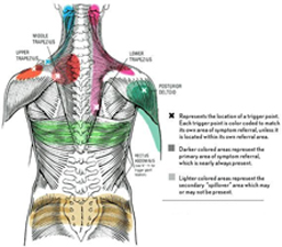 referral pain diagram